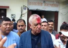 Dr.-Shashank-Koirala-Nomination